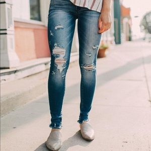 Buckle Kancan Mid Rise Ankle Skinny